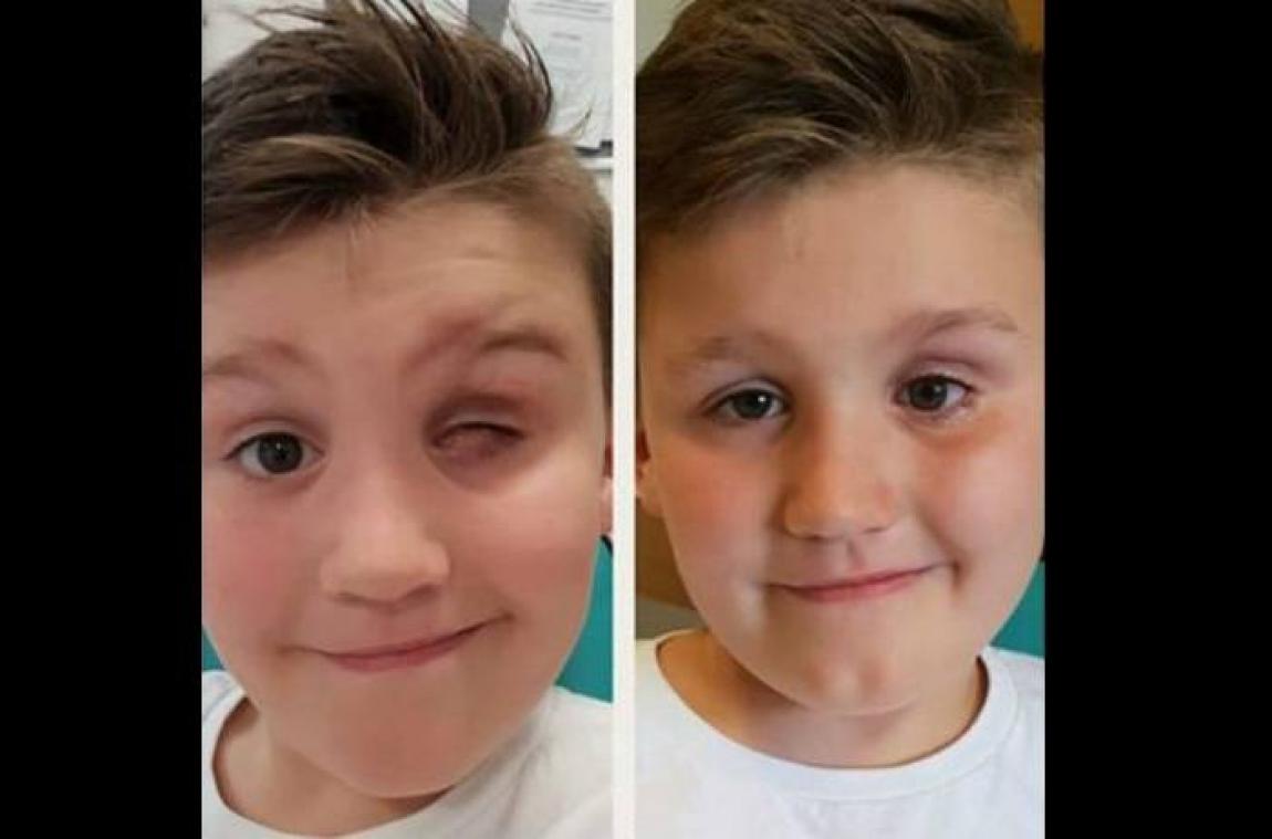 Un garçon de 9 ans perd un œil à cause d'un jouet Nerf - Metrotime
