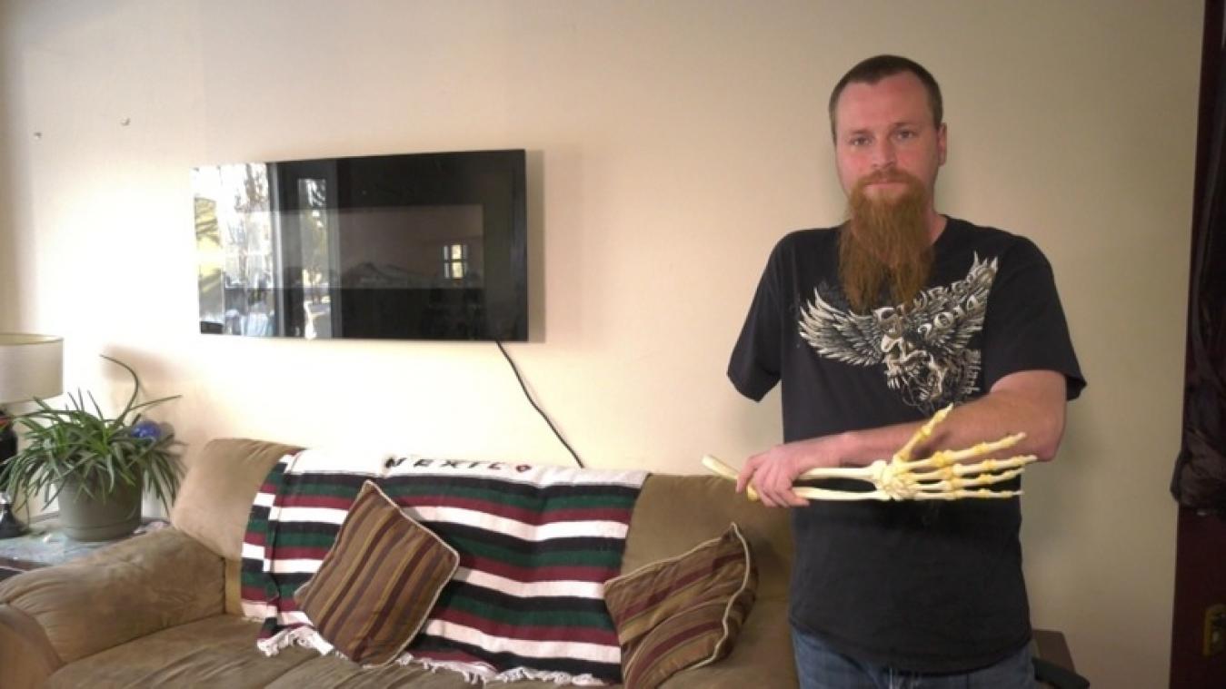 Bras Amputé Task Trainer | X1400