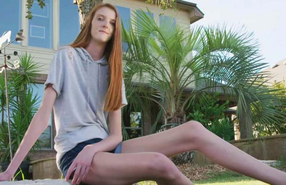 VIDEO. Dit 16-jarige meisje heeft de langste benen ter wereld - Metrotime