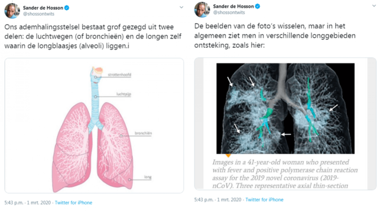 Longarts toont aan wat het coronavirus met je longen doet - Metrotime
